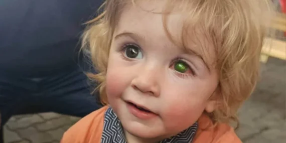 Bebeklerde Göz Bozukluğu Belirtileri Nelerdir? Erken Teşhis İçin Dikkat Edilmesi Gerekenler