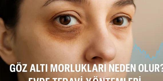 Göz Altı Morlukları Neden Olur? Evde Doğal Tedavi Yöntemleri