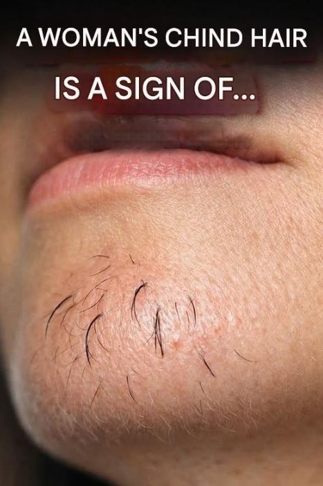 Understanding Chin Hair Growth in Women and Its Possible Hormonal Links