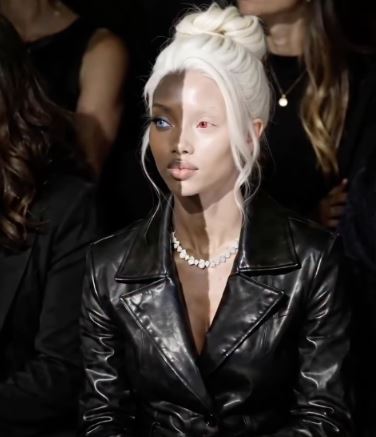 A Model’s Distinctive Look Captivated Millions — Here’s What People Learned